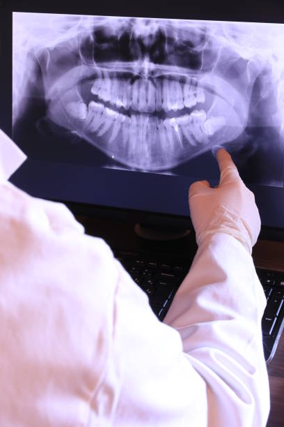 Best Emergency Tooth Extraction in South Amherst, OH