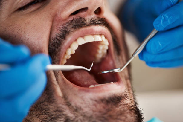 Best Emergency Broken Tooth Repair in South Amherst, OH